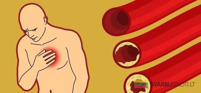 9 produktów spożywczych, które naturalnie udrożnią Twoje tętnice